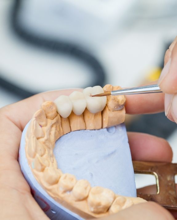 Dentist using a brush to refine a dental bridge on a plaster cast of teeth.