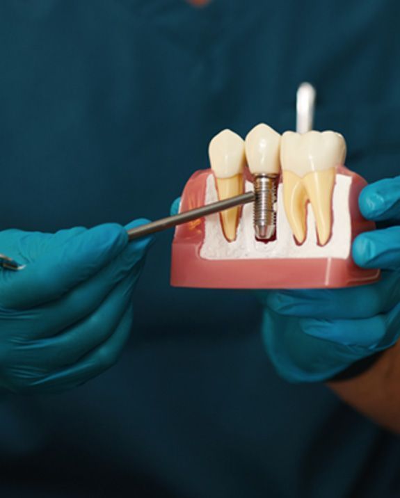 same-day dental implants