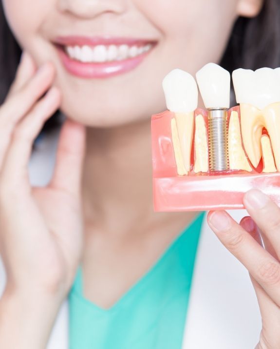 Single tooth implant