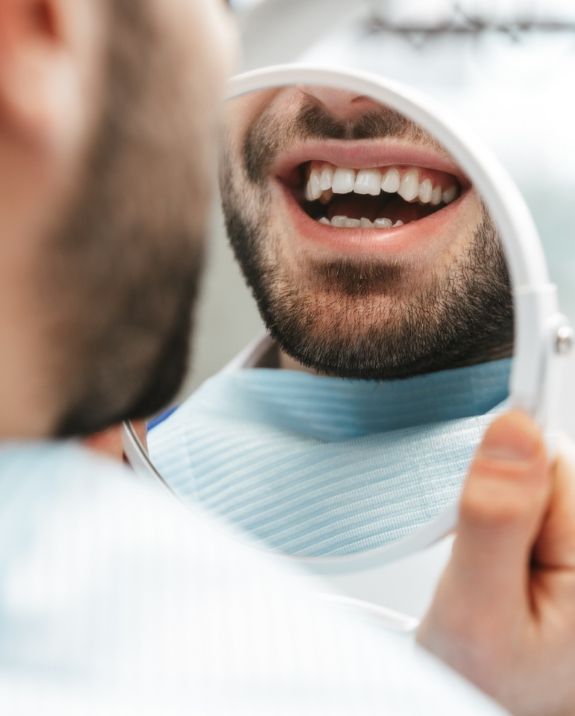 no-prep veneers