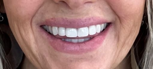 Teeth 