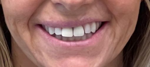 Teeth 
