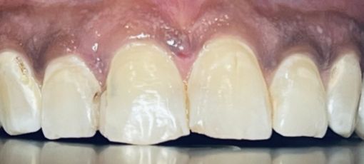 teeth 