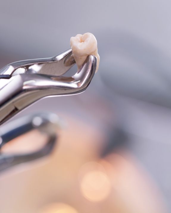 Dentist examining a patient's teeth with tools, the patient wearing protective glasses, indoor setting.