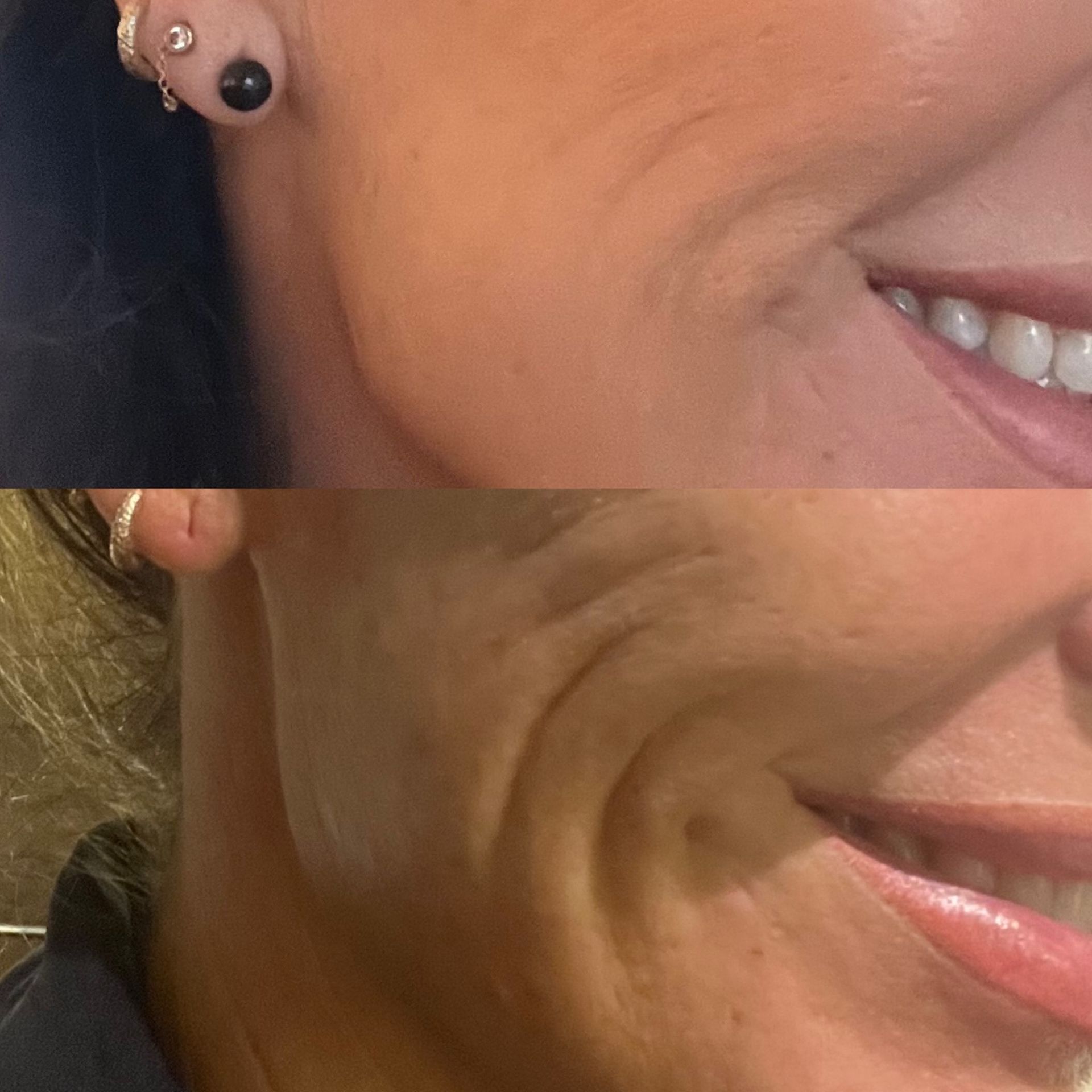 Ein Vorher-Nachher-Bild des Gesichts einer Frau mit Ohrringen.
