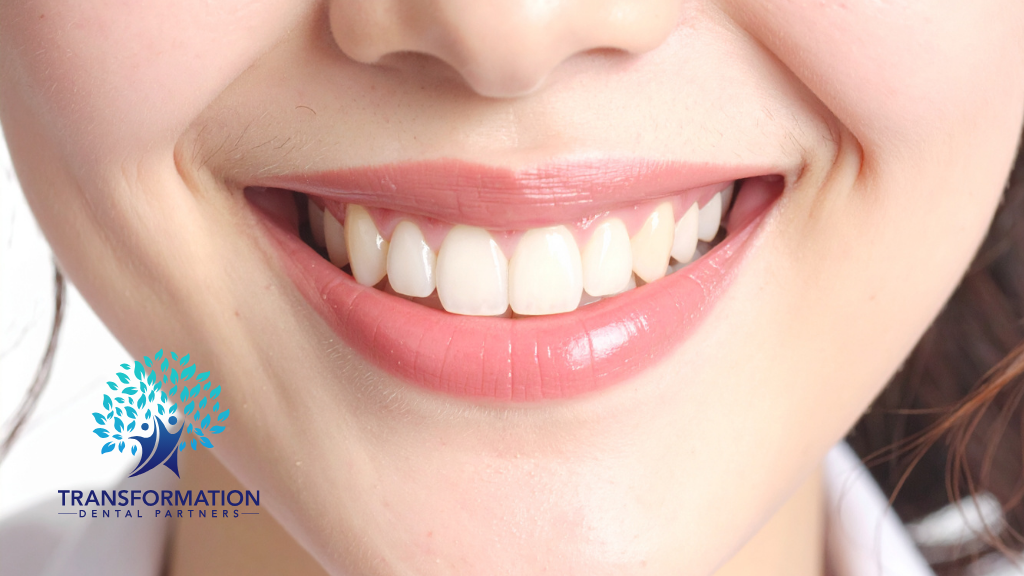 Close-up of a smiling mouth with bright white teeth and pink lips; part of a woman's face.