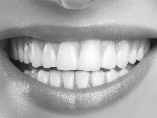 Gros plan sur une bouche souriante montrant des dents d'un blanc éclatant et des lèvres brillantes.