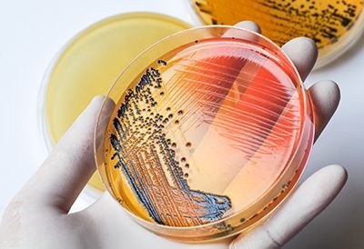 A person is holding a petri dish with bacteria in it.