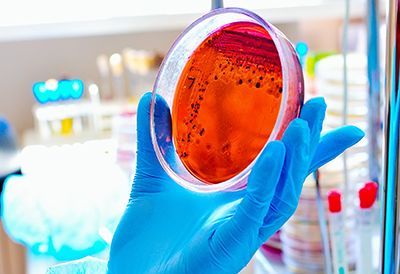 A person wearing blue gloves is holding a petri dish with a red liquid in it.