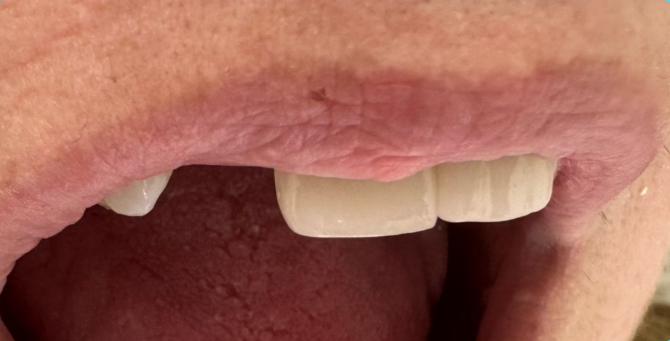 Close-up of a person's mouth with slightly parted lips and visible front teeth