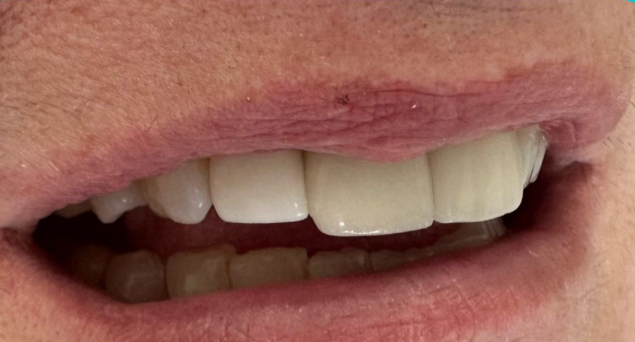 Close-up of a smiling mouth with slightly parted lips and white teeth