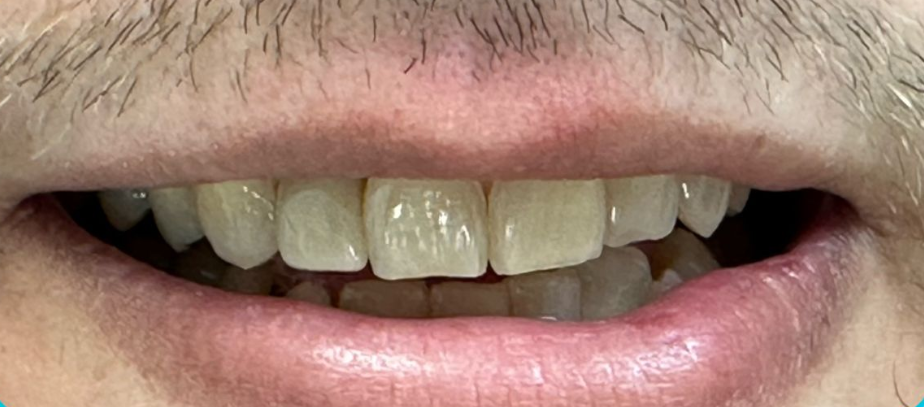 Close-up of a smiling mouth showing teeth and lips