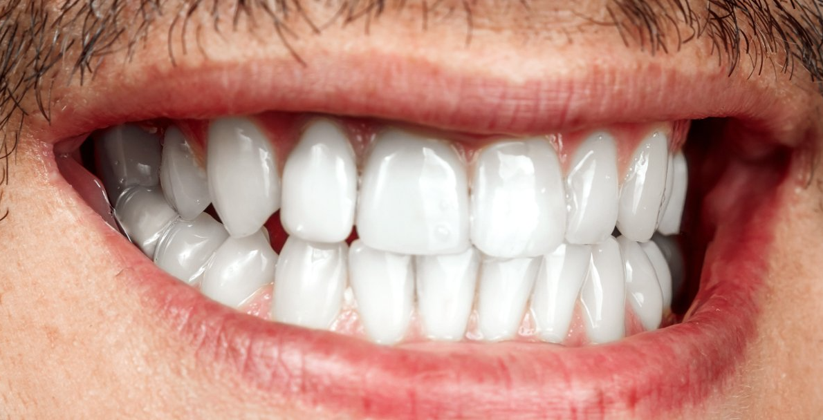 Close-up of a smiling mouth showing white teeth and pink lips