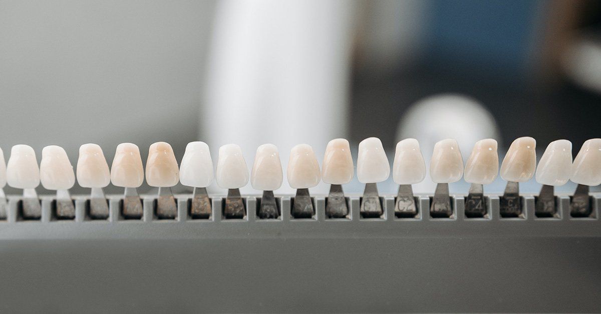dental implants vs dentures