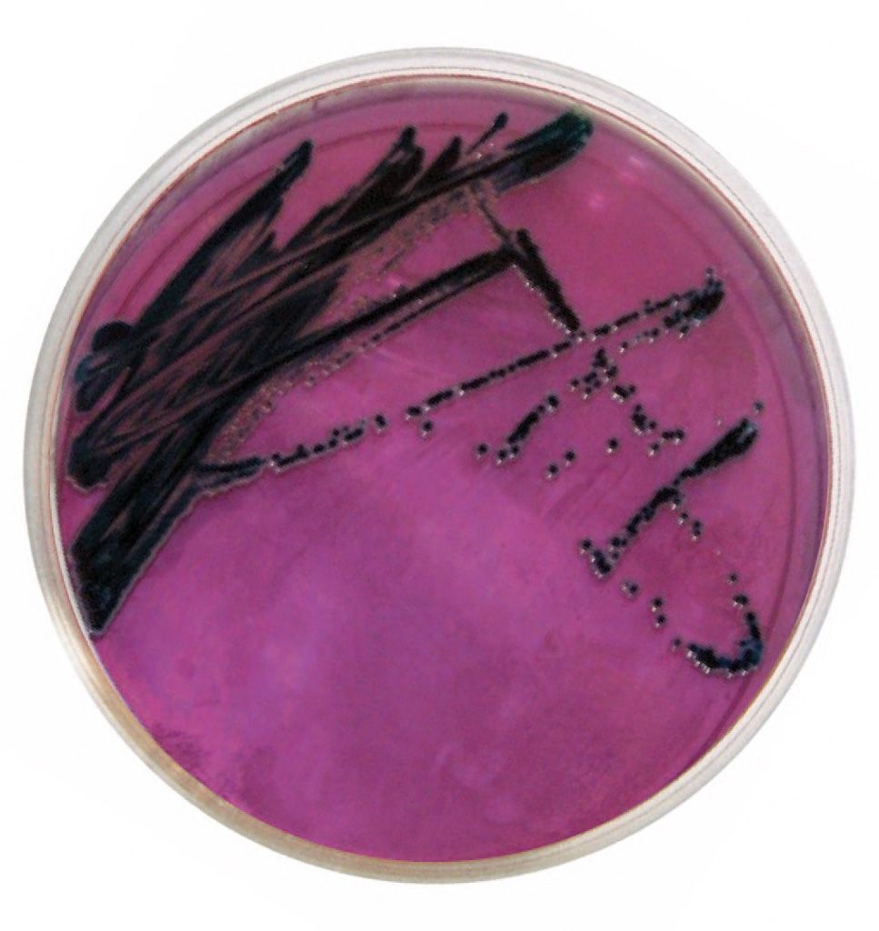 A petri dish filled with purple liquid and black bacteria
