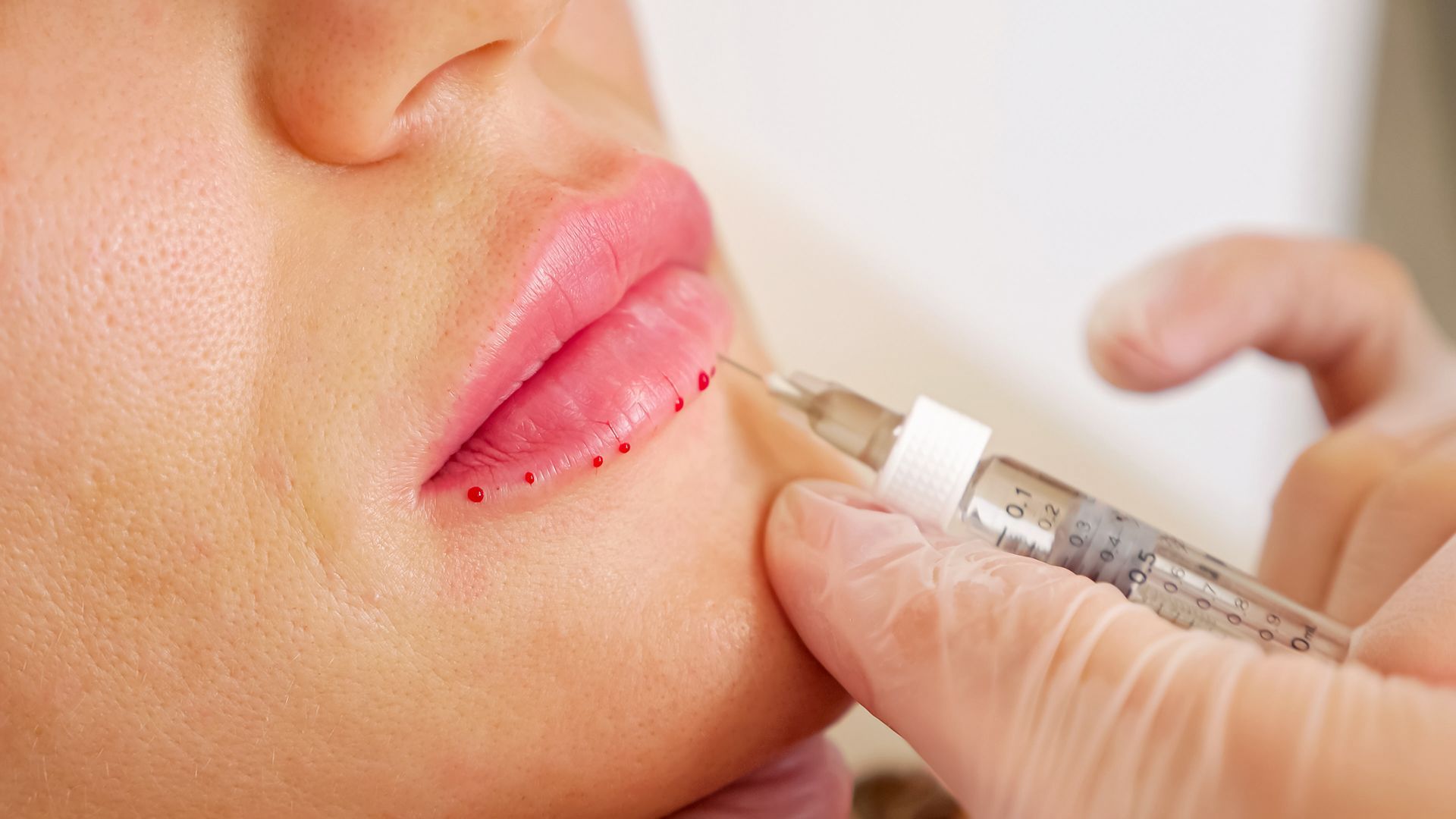 Close-Up of A Doctor Making an Injection