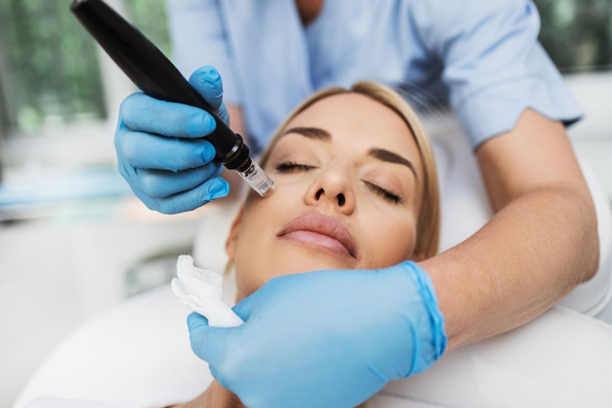 Microdermabrasion Treatment on Face