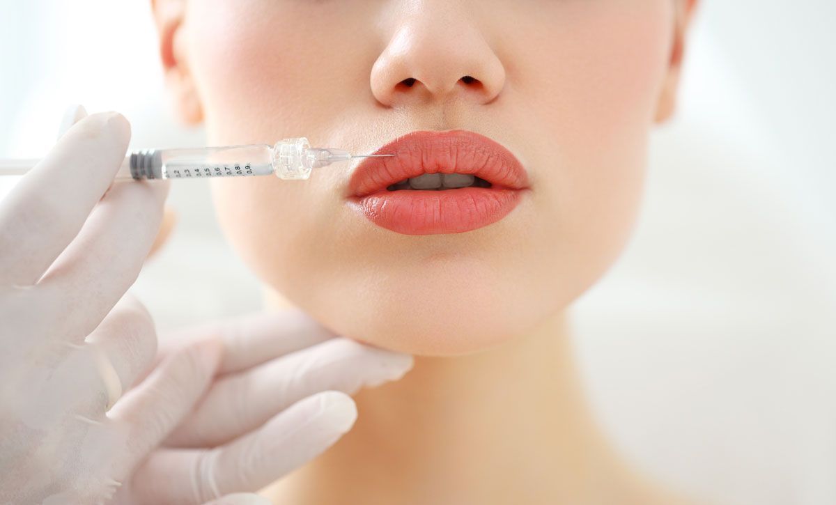 Lip Filler
