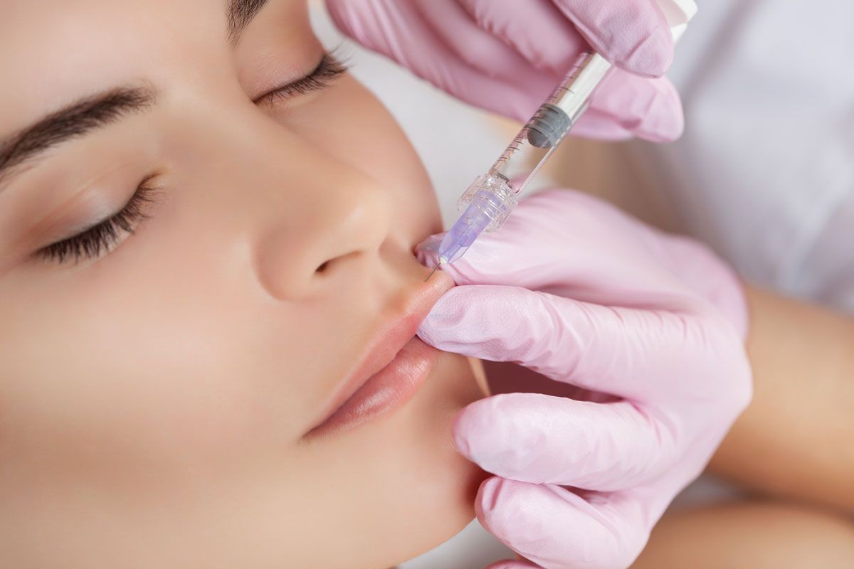 Lip Filler Treatment