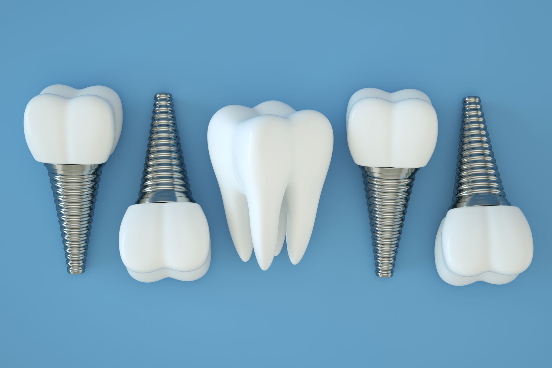 dental implants with crowns