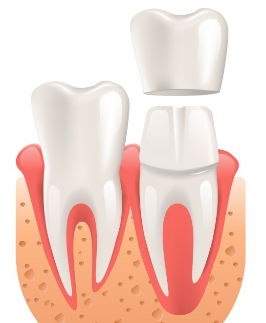 Dental Cross Section Cross Section Illustration