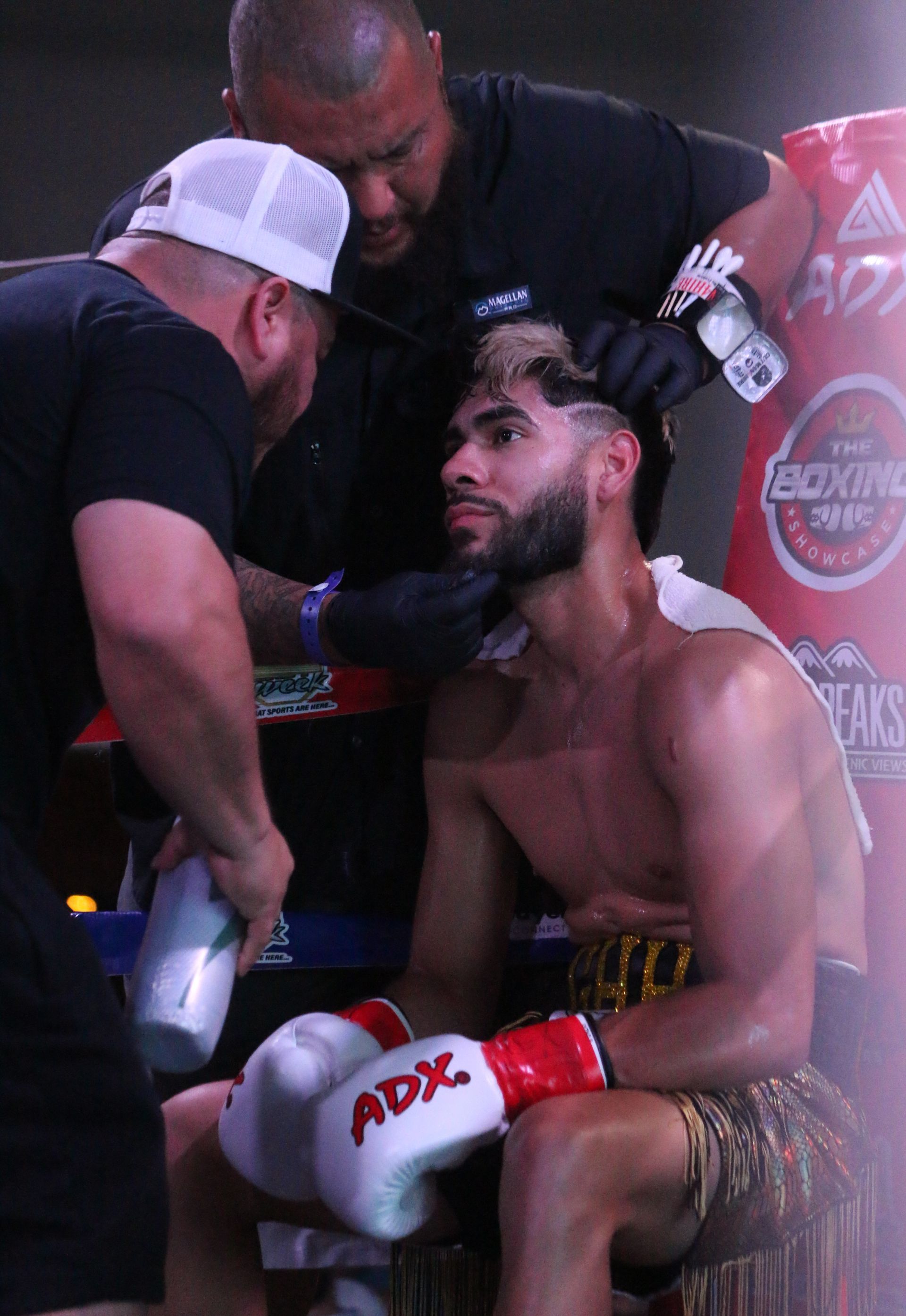 Boxer seated in corner between rounds as two trainers attend him, blood on face and gloves visible.