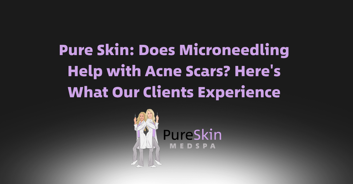 Purple text on black promoting Pure Skin Medspa’s microneedling for acne scars, with logo below