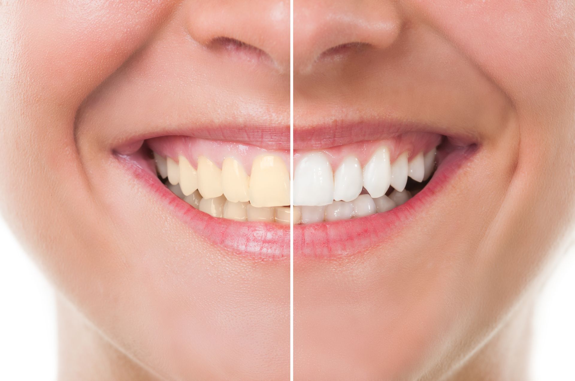 Dental Bridges Westdale North | Dental Crowns Westdale North