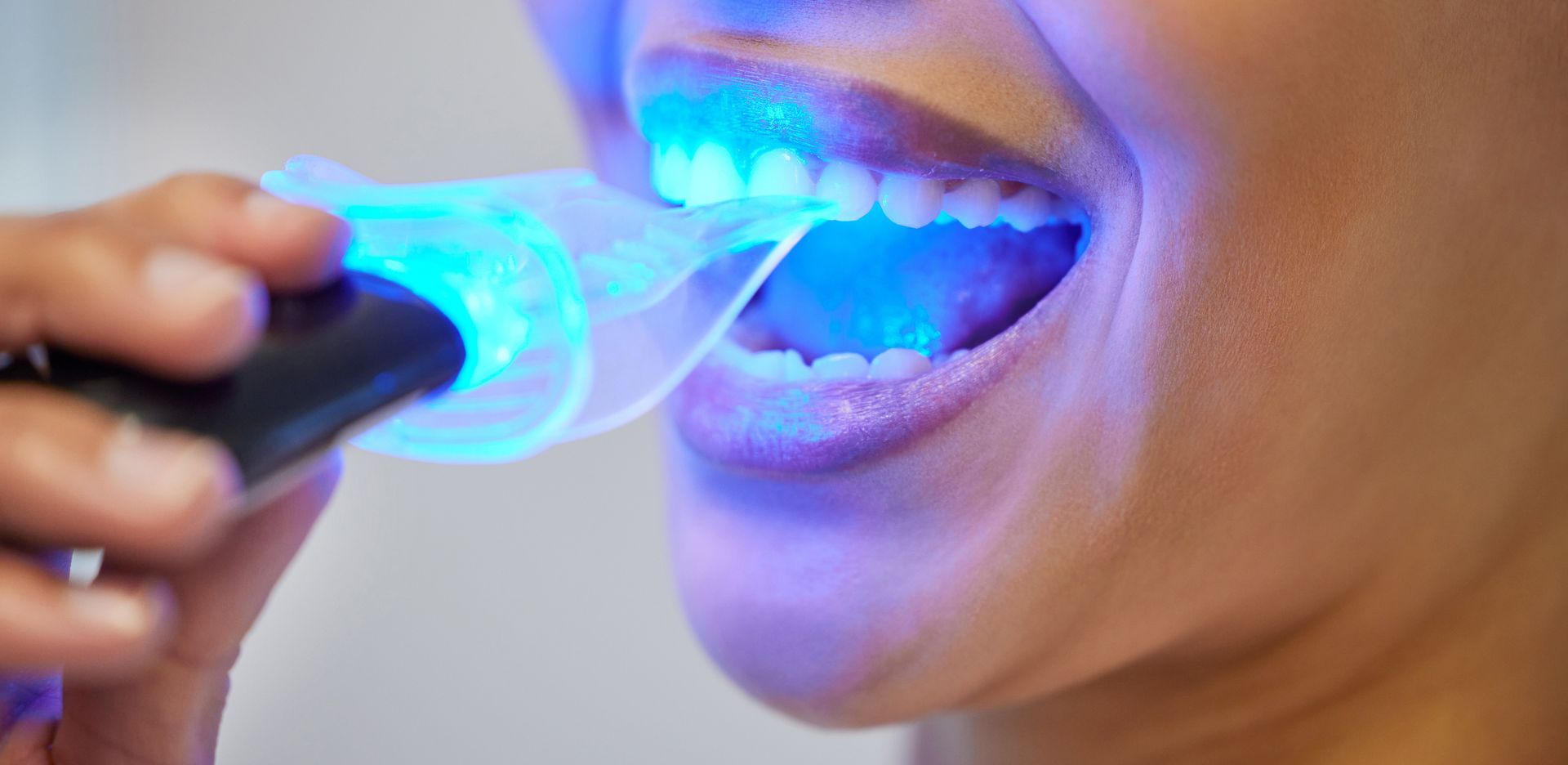 Dental care for McMaster students