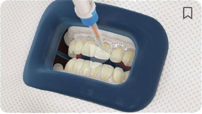 A close up of a person 's teeth being whitened.