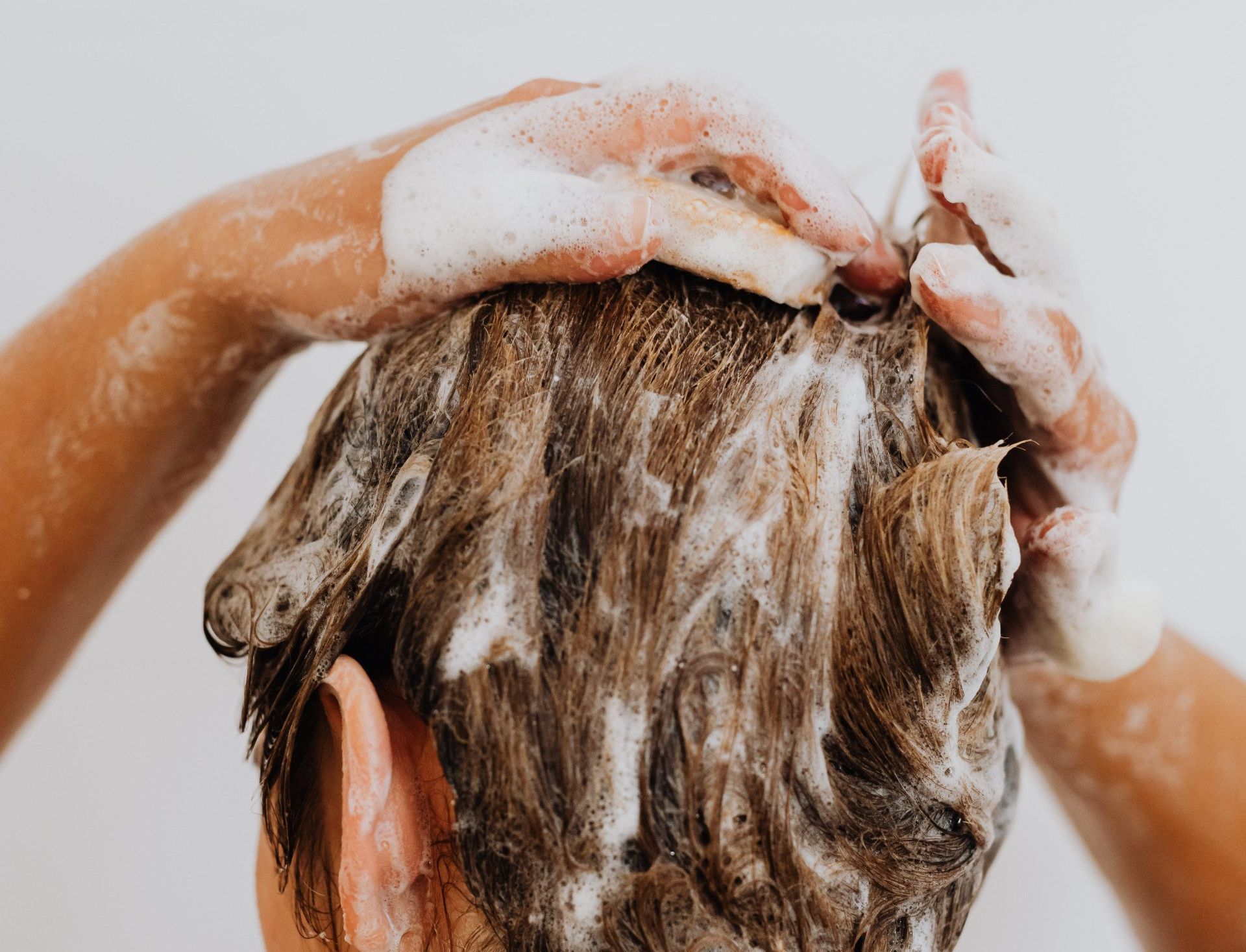 Patient caring for the hair after an implant in colombia
