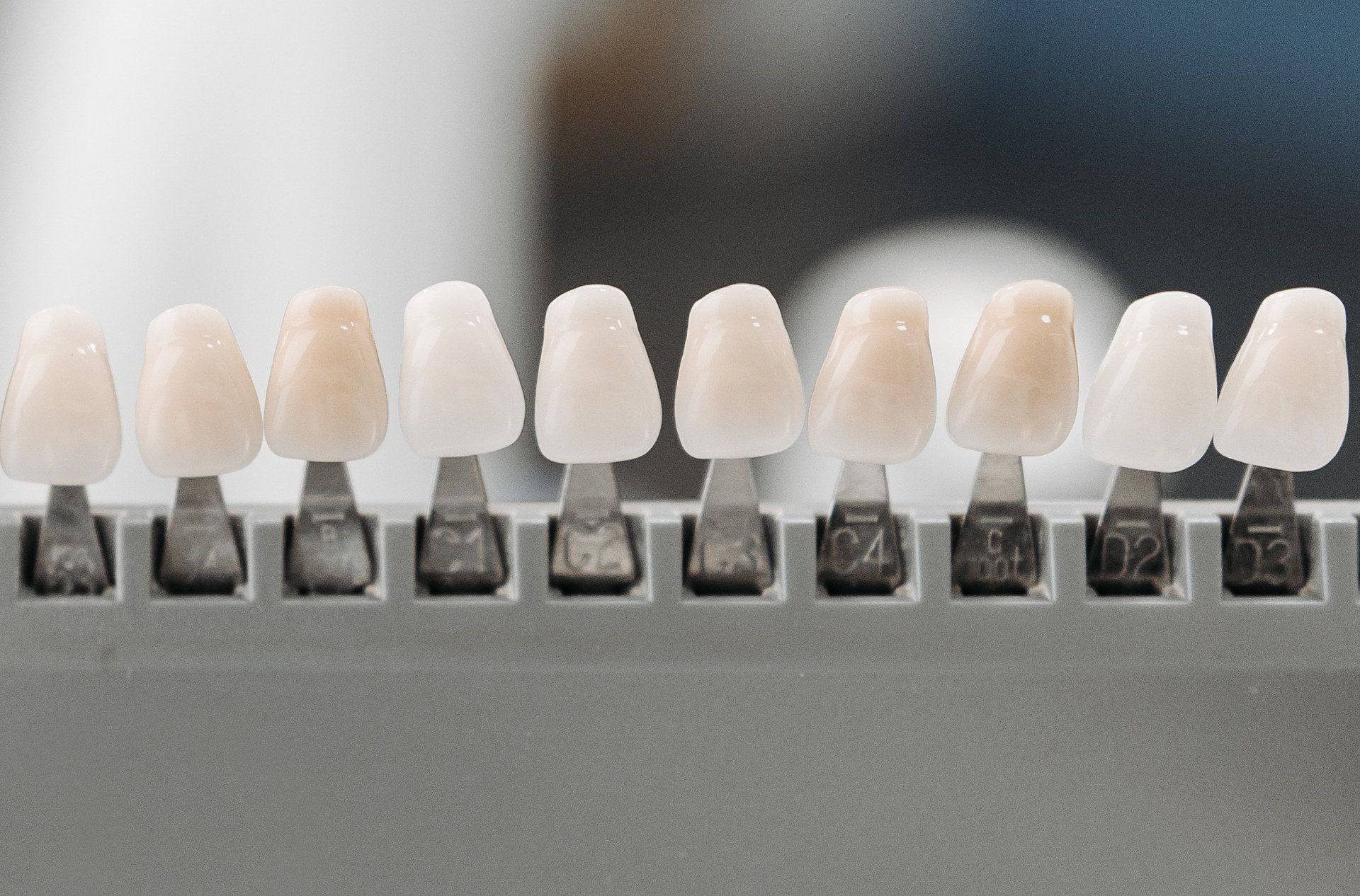 Cost-Effective Dental Veneer Options in Colombia