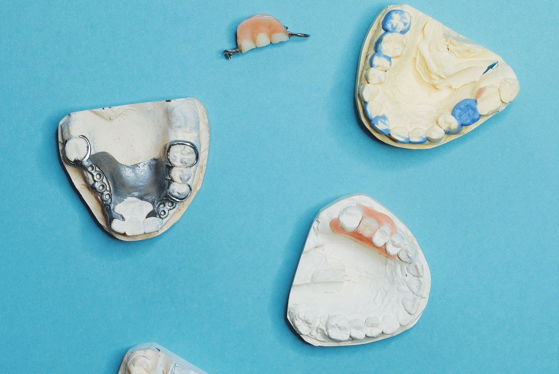 Close-up view of a dental implant model