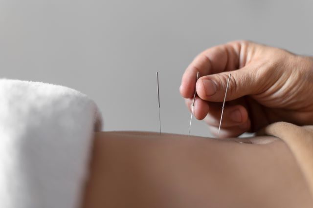 AGOPUNTURA: MINOR RISCHIO ICTUS LEGATO ALL'ARTRITE REUMATOIDE