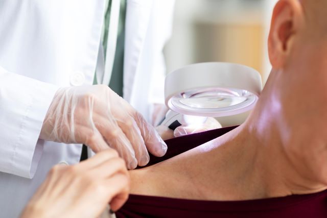 ARTRITE REUMATOIDE E HERPES ZOSTER