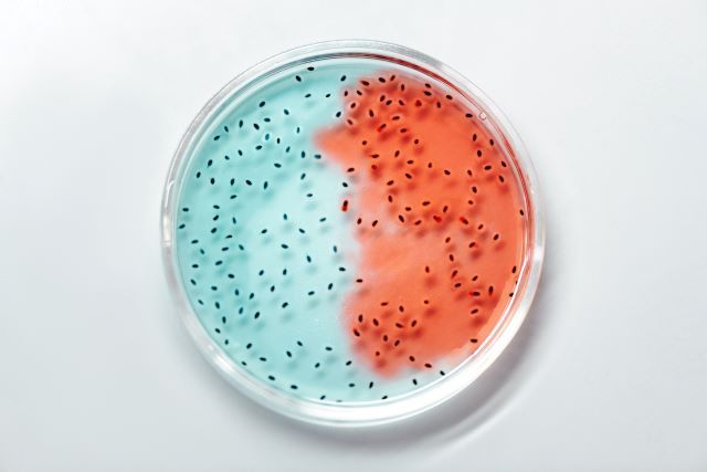 ARTRITE REUMATOIDE: SCOPERTO COLLEGAMENTO CON BATTERI E INTESTINO