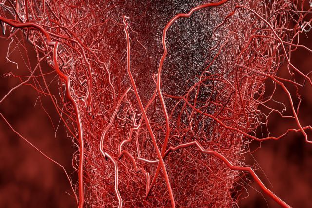 VASCULITE