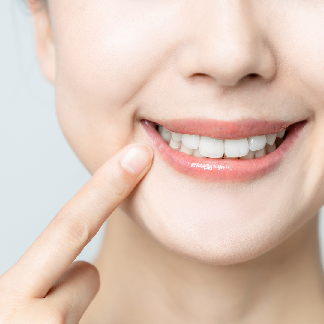 Person pointing at a bright, white smile; pink lips; light background.