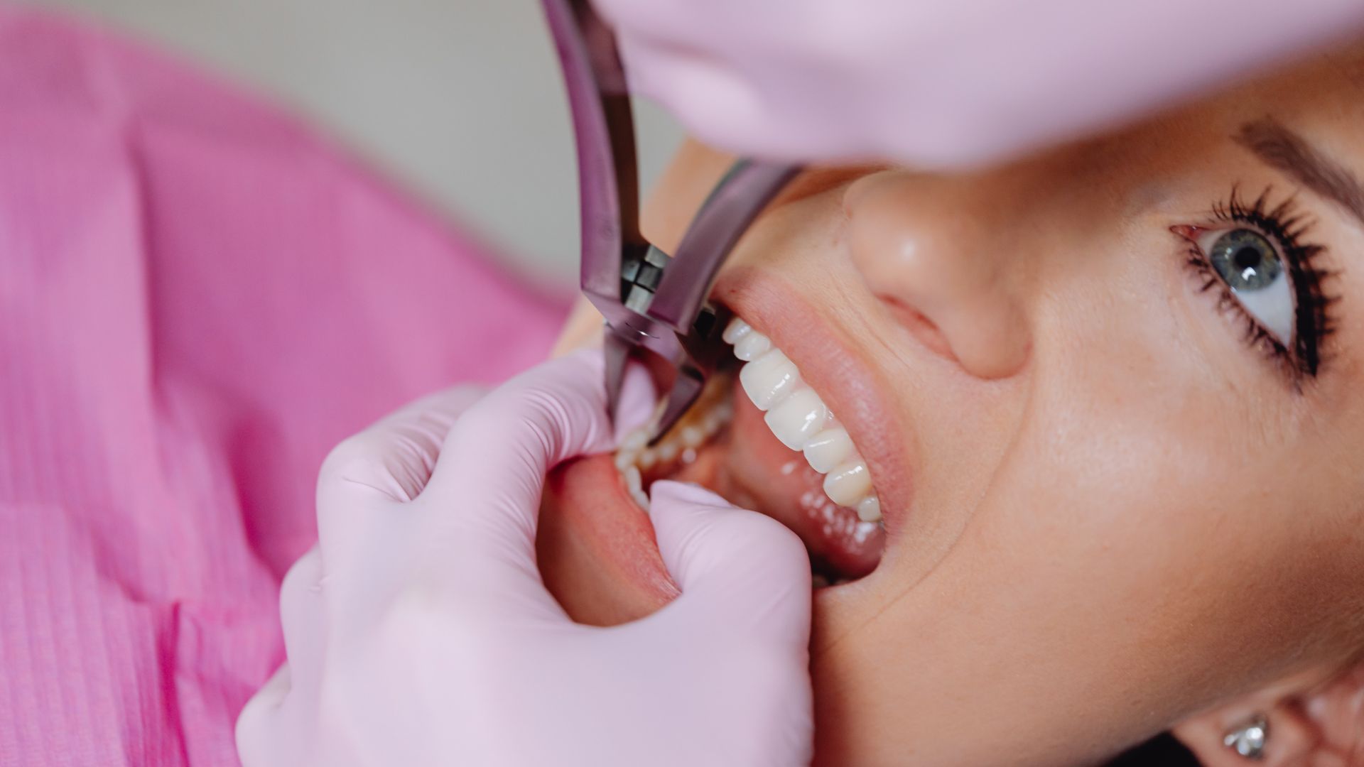 Dentist using a tool on a patient’s open mouth during a dental exam