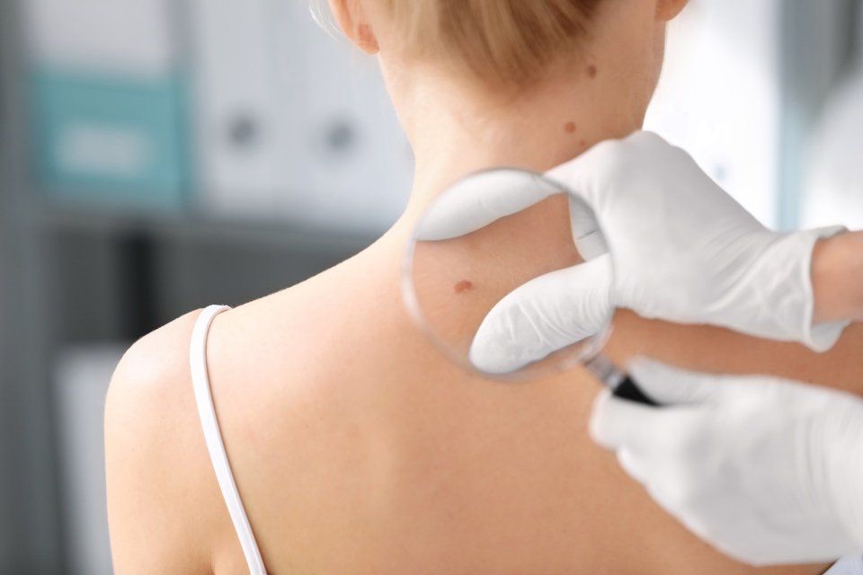 controllo dei nei presso lo studio di dermatologia