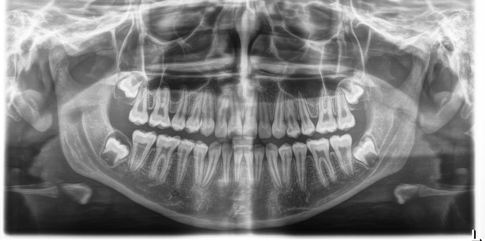 A close up of a person 's teeth and mouth.