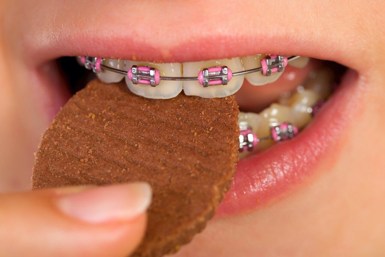 A woman with braces is eating a cookie.