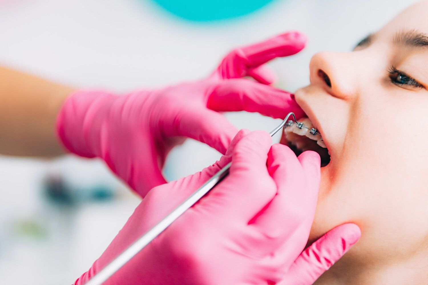A young girl with braces is getting her teeth examined by a dentist.