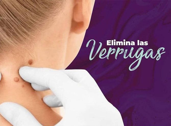 DRA. PATRICIA E. RODIL POSADA - ELIMINA LAS VERRUGAS DRA. PATRICIA E. RODIL POSADA - ELIMINA LAS VERRUGAS