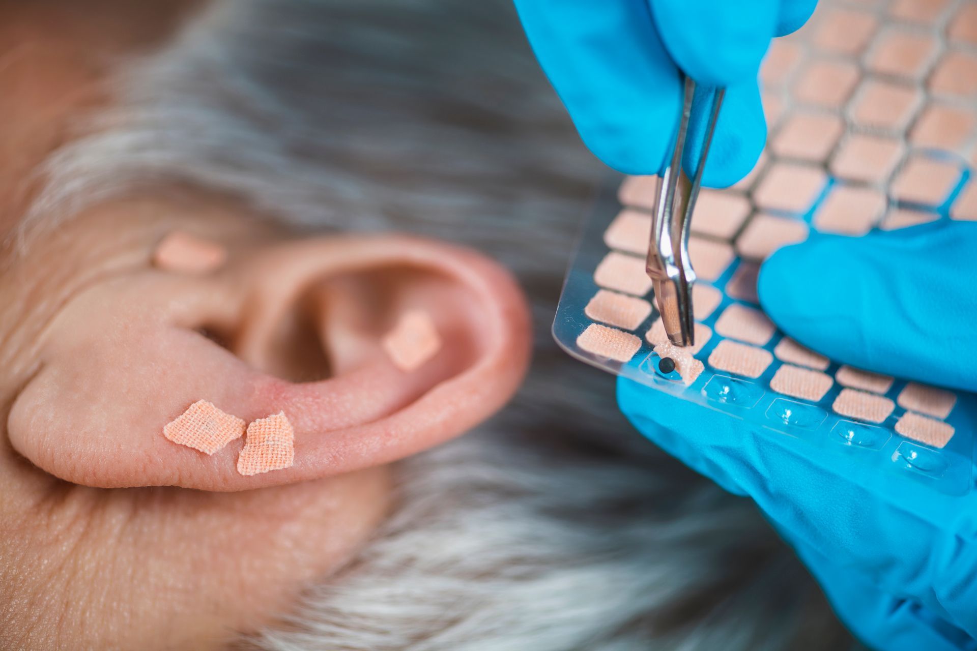 Auricular Treatment on Human Ear