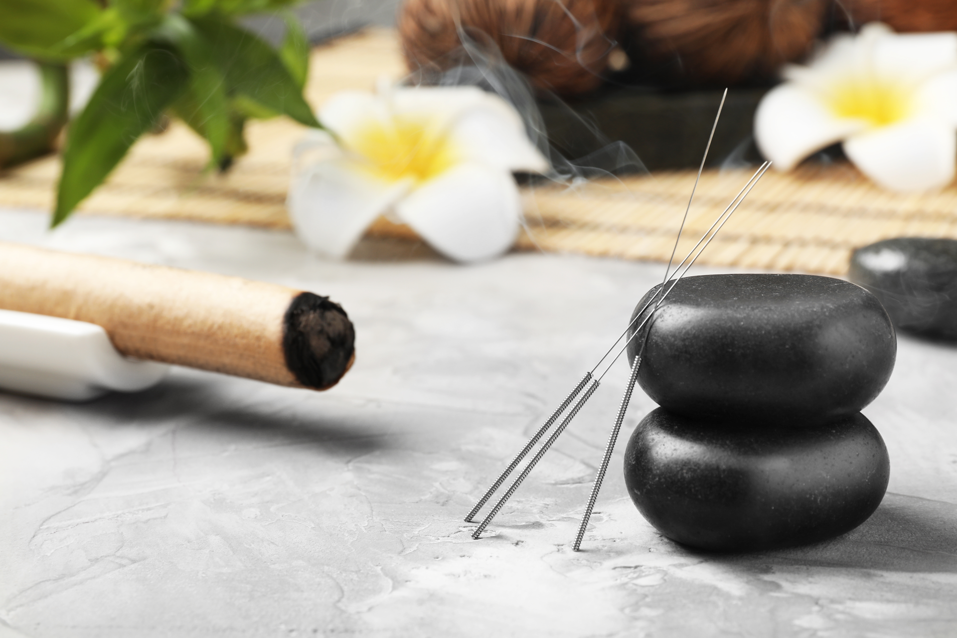 Acupuncture Package Deals