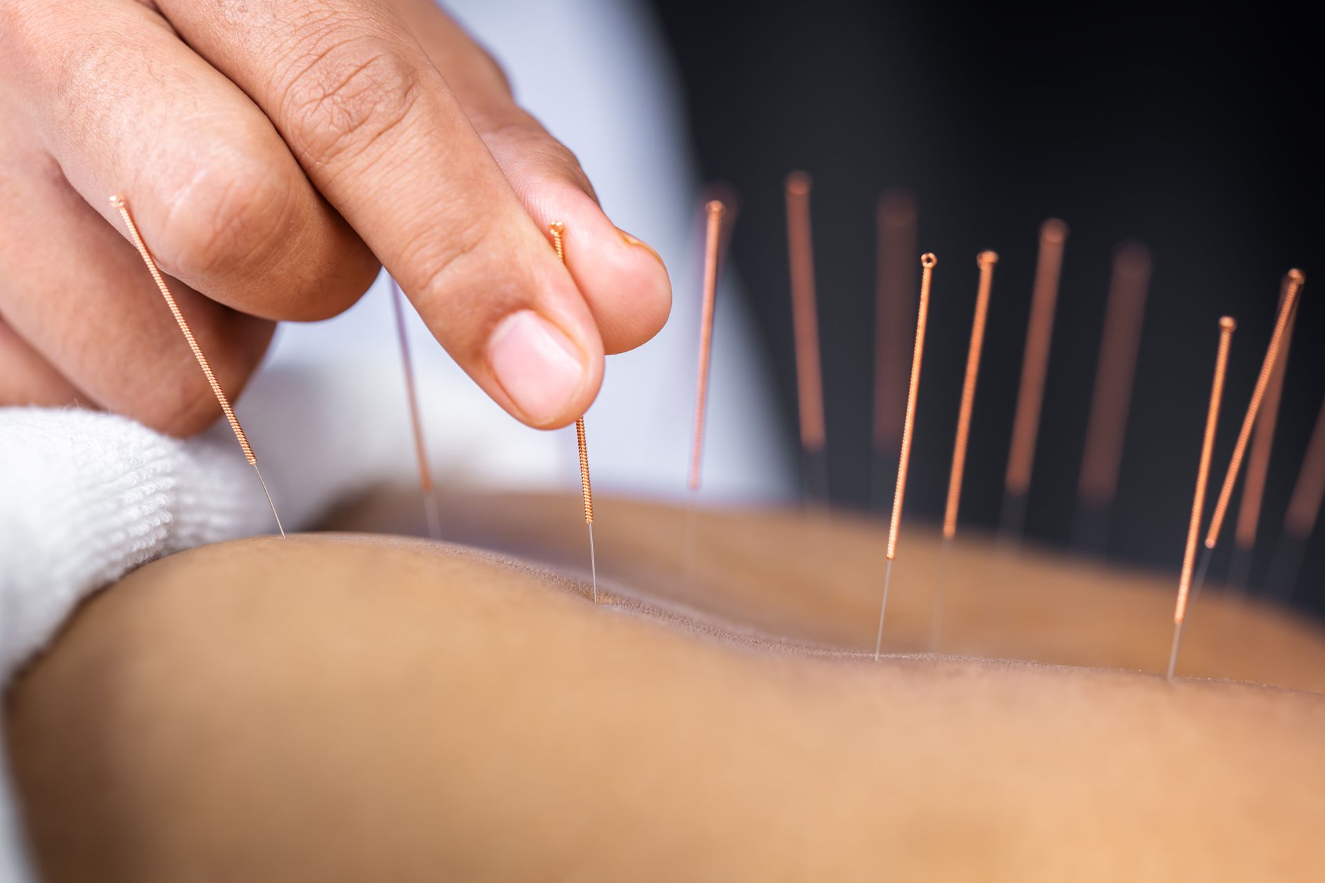 Traditional Chinese Medicine