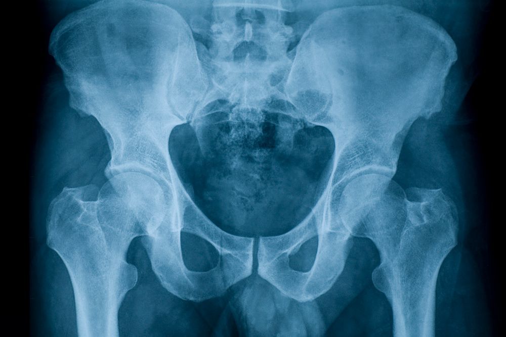 Hip — Geelong, VIC — Andrew Byrne Orthopaedic and Sports Injury Surgeon