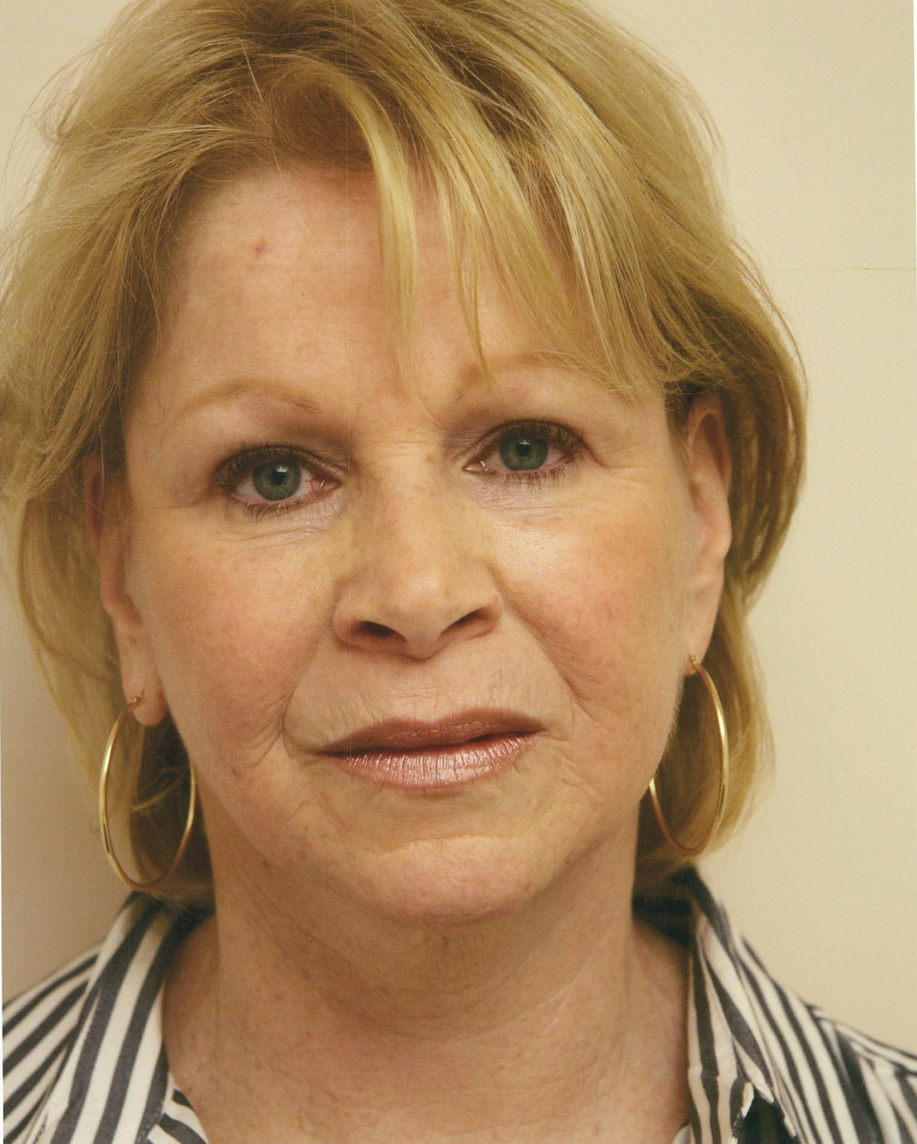 Woman with blonde hair, wearing gold hoop earrings, and striped shirt, looking forward.