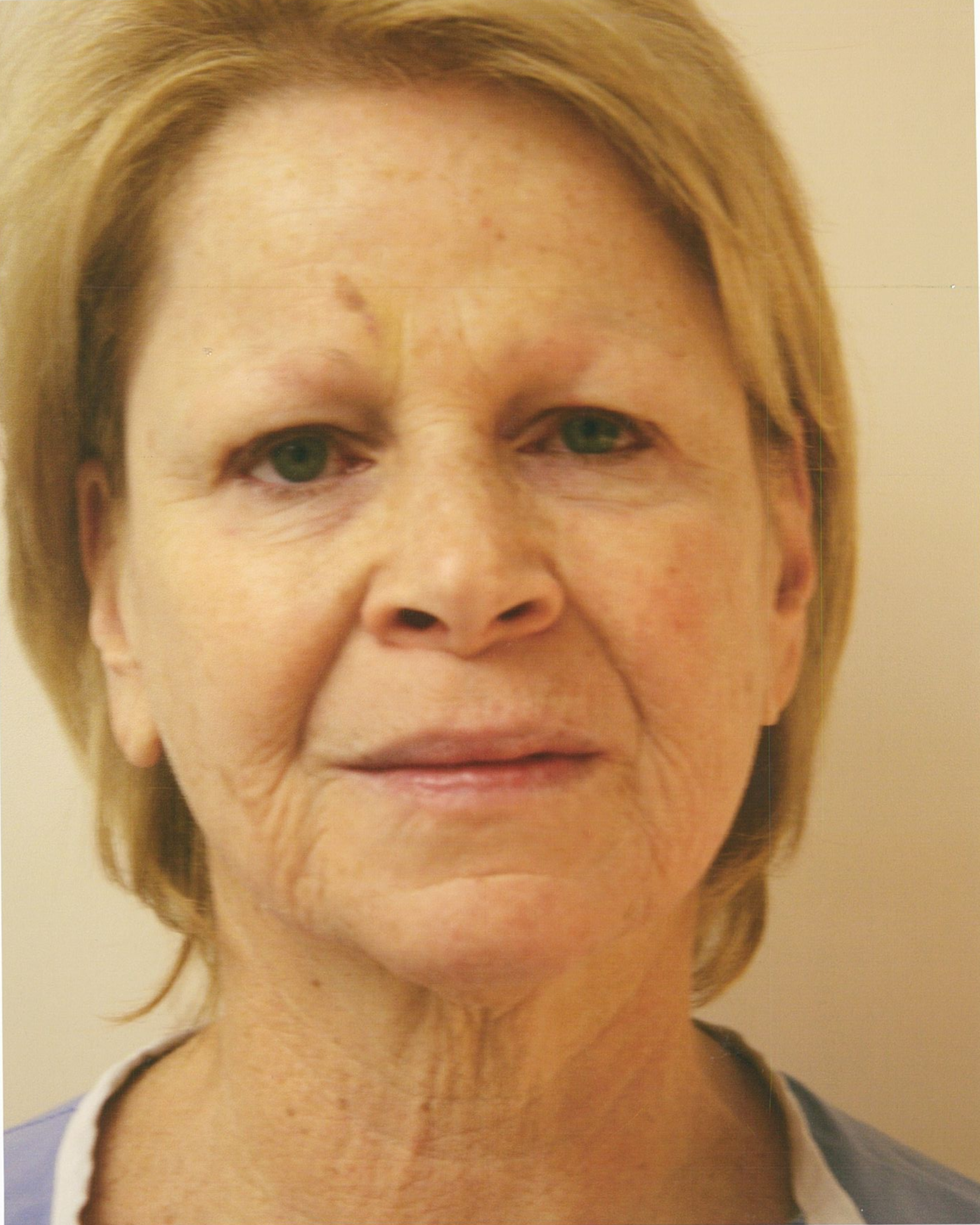 Mature woman with fair skin, wrinkles, and light brown hair, looking at the camera.
